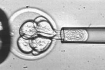 Cientistas criaram células estaminais a partir de pele humana
